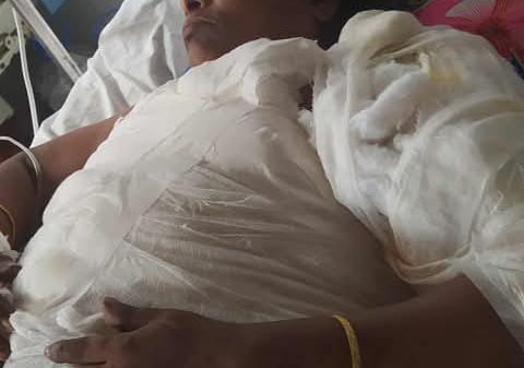 চট্টগ্রাম পশ্চিম পটিয়া কোলাগাঁও গরম পানি ঢেলে এক নারীকে পুড়িয়ে দেওয়ার অভিযোগ!